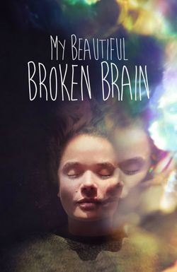 My Beautiful Broken Brain