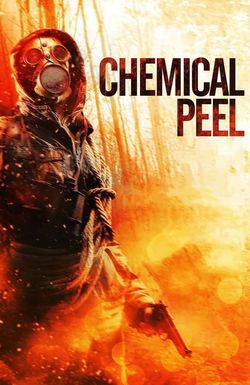 Chemical Peel