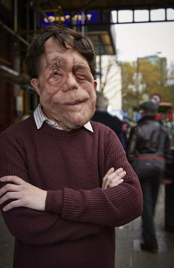 The Ugly Face of Disability Hate Crime