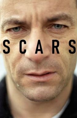 Scars