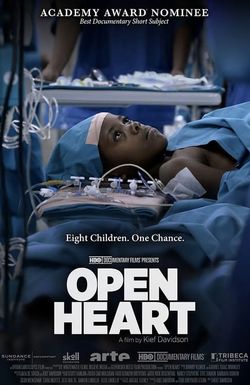 Open Heart