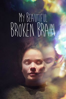 My Beautiful Broken Brain