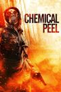 Chemical Peel