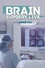 Brain Surgery Live with Mental Floss