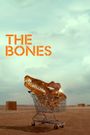 The Bones