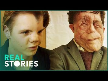 The Ugly Face of Disability Hate Crime (Adam Pearson Documentary) | Real Stories